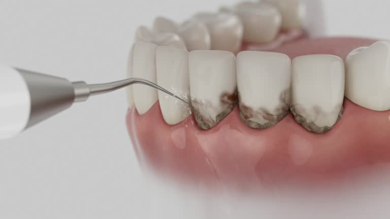 Trusted Emergency Dentist service in Jeffersonville, OH - Dentist Open Now